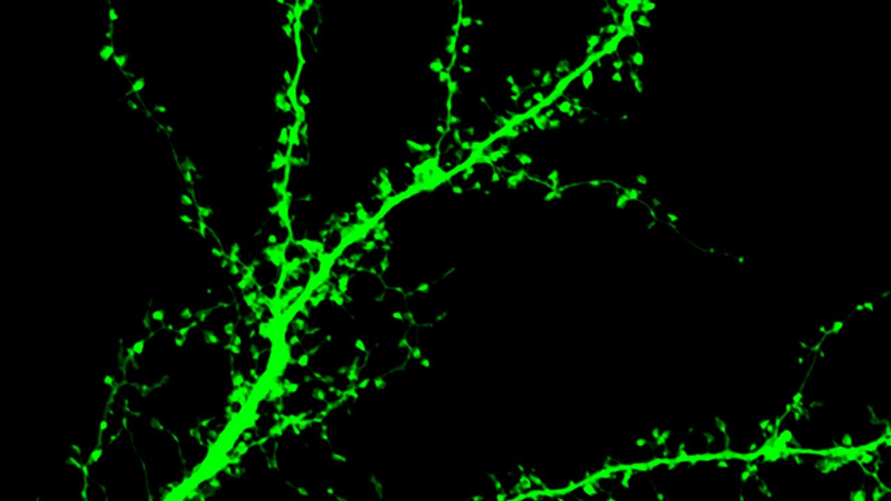 Neuroscience 10