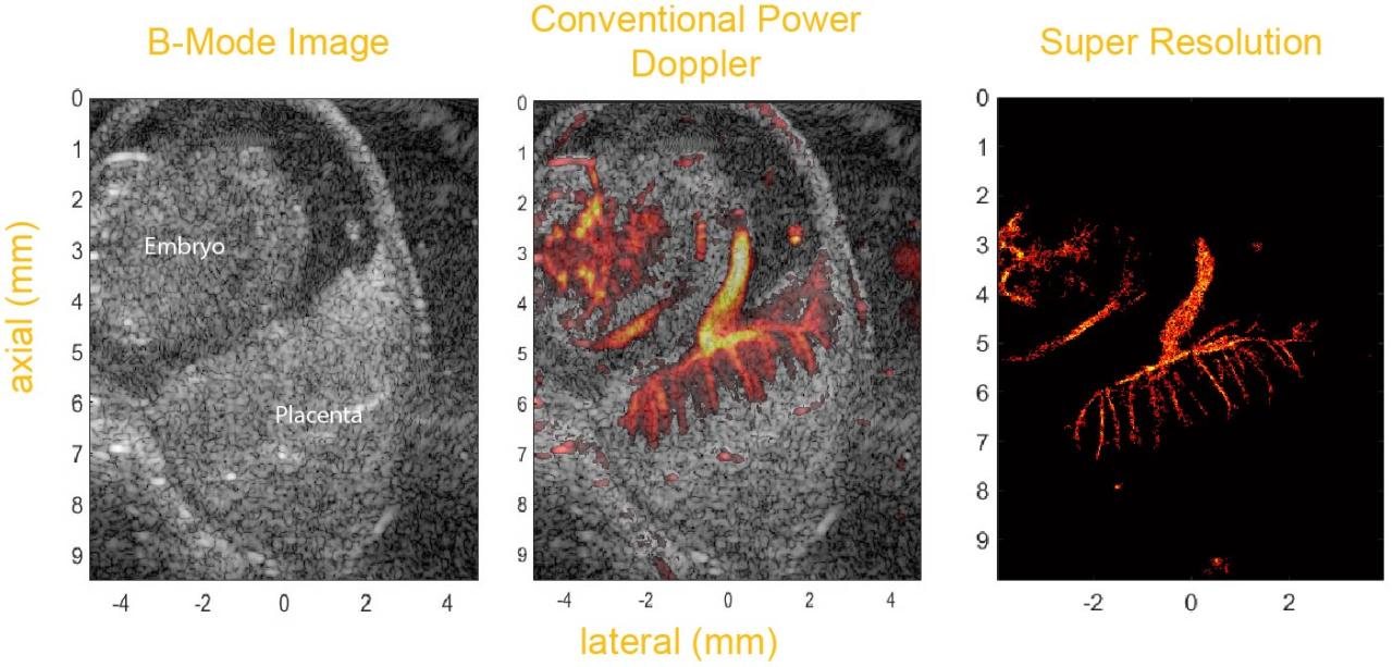 Kettering Lab Placenta Image