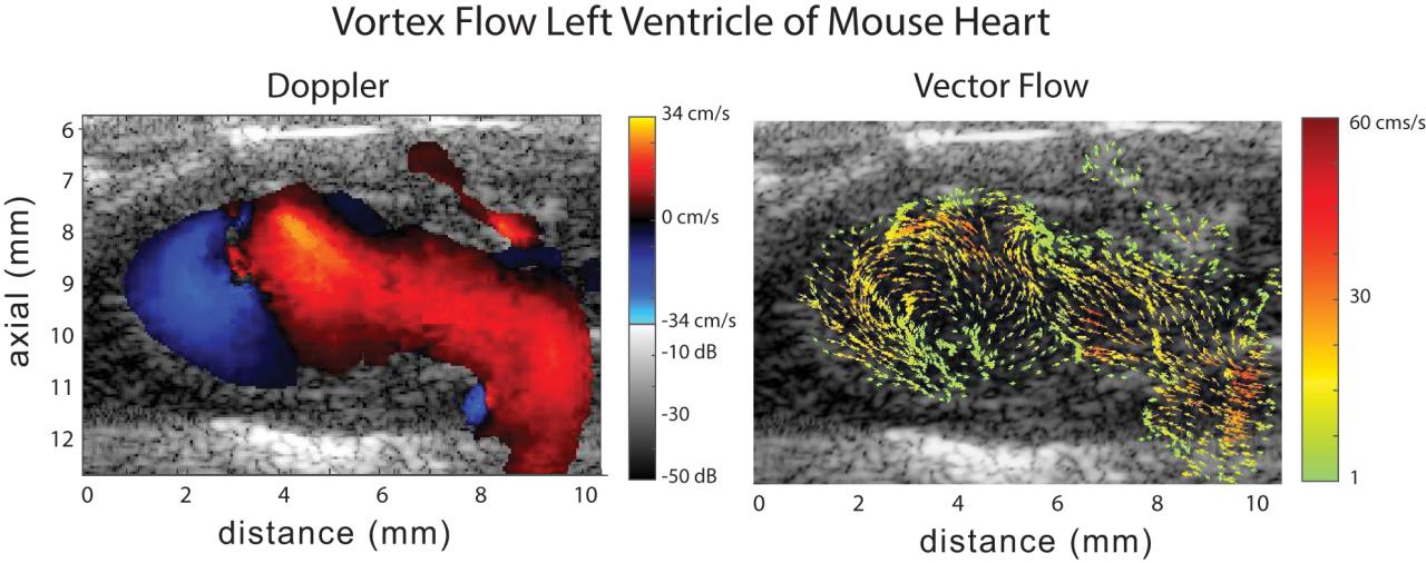 Kettering Lab Vortex Flow Left Ventricle of Mouse Heart