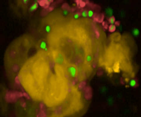 Hopkins Organoid Co Culture